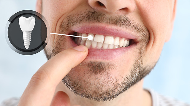 The image shows a man with a beard using a small dental tool to clean his teeth.