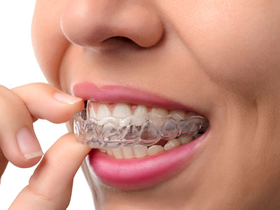 A woman with clear braces on her teeth, focusing intently on them while sitting in front of a white background.