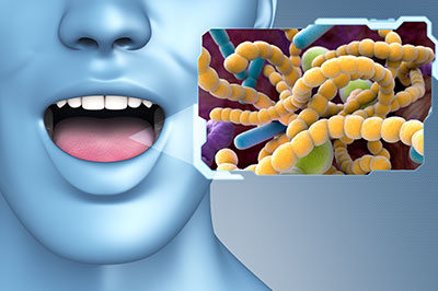 The image is a digital composite featuring a human face with an open mouth, superimposed on a background that includes a close-up of bacteria and a label or icon.