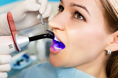 A woman is seated in a dental chair, receiving dental treatment involving a blue device and purple liquid.