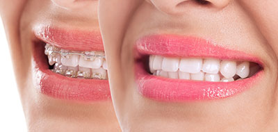 A split-screen image of a smiling woman with two distinct shades of lipstick, showcasing the difference in color.