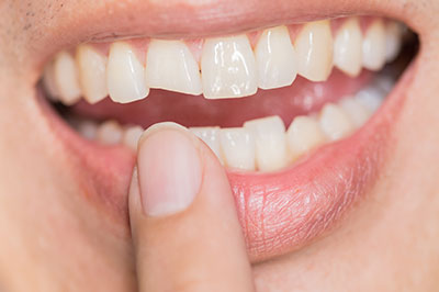 An image of a close-up of a person s mouth with teeth and lips, holding their finger near the teeth.