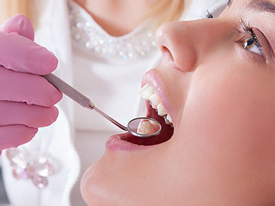 A dental professional using a drill to clean or repair a patient s teeth.